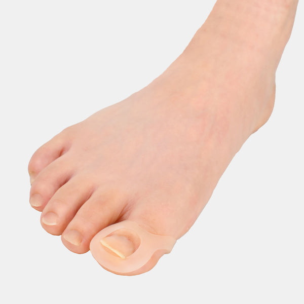 巻き爪ゲルサポーター