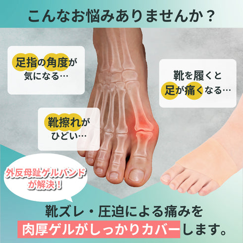 外反母趾ゲルバンド