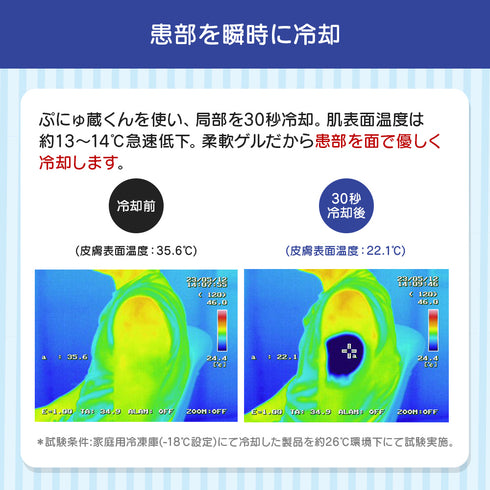 ぷにゅ蔵くん 穿刺痛低減アイスパック(6個1セット)